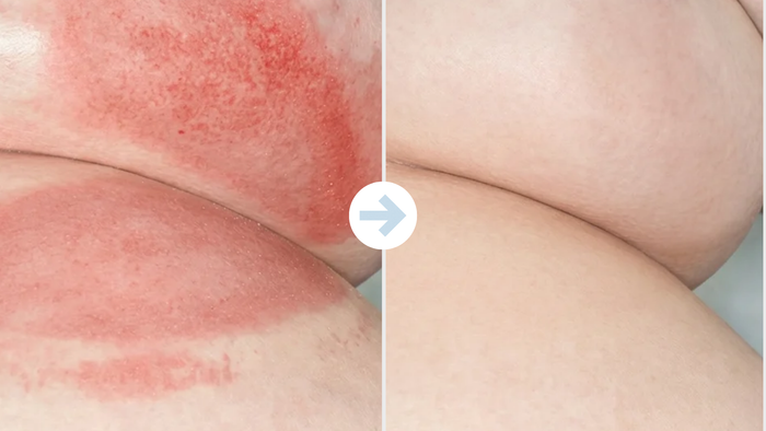 Underboob before and after using the anti-friction stick